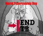 Wereldtuberculosedag, 24 maart. De tuberculose is een van de belangrijkste doodsoorzaken onder de besmettelijke ziekten in de wereld. In 1882 maakt Robert Koch zijn ontdekking van de bacterie die tuberculose